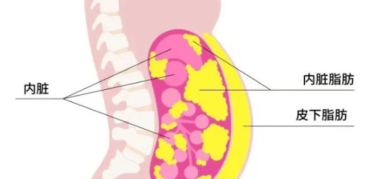Which type of liposuction yields better results